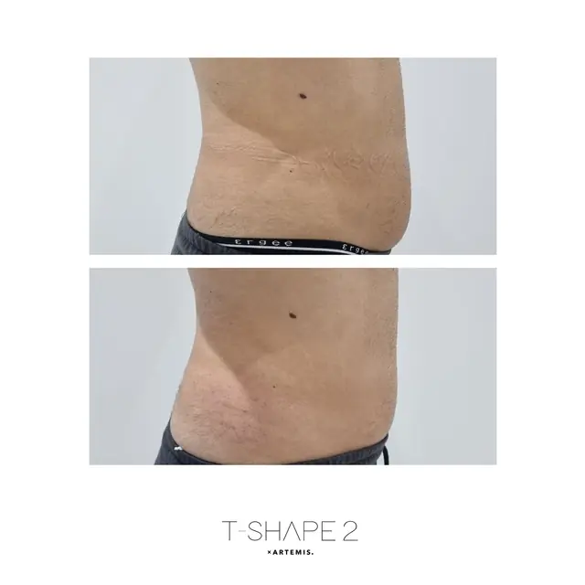 T-Shape 2 result — Side 1